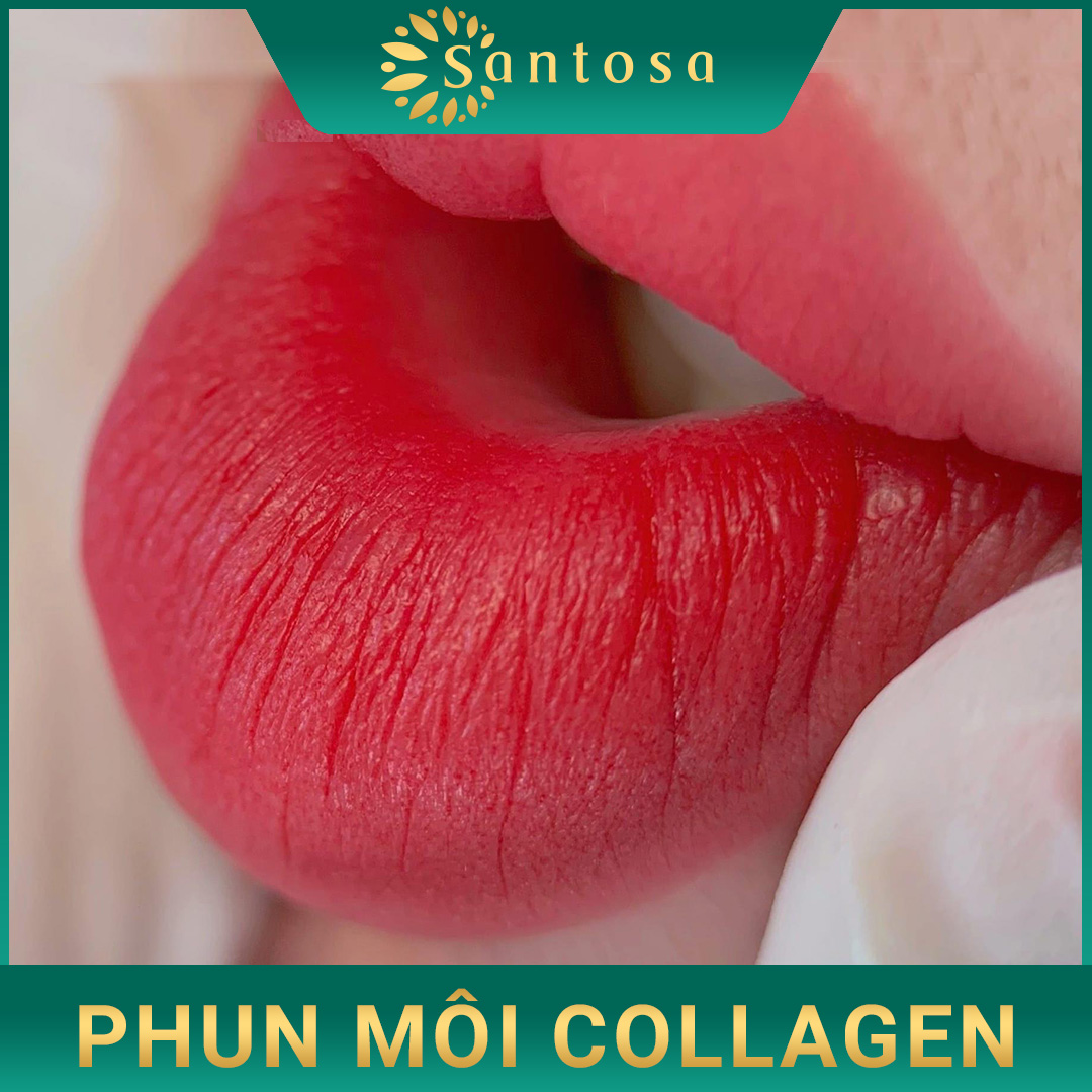 phun môi HA collagen